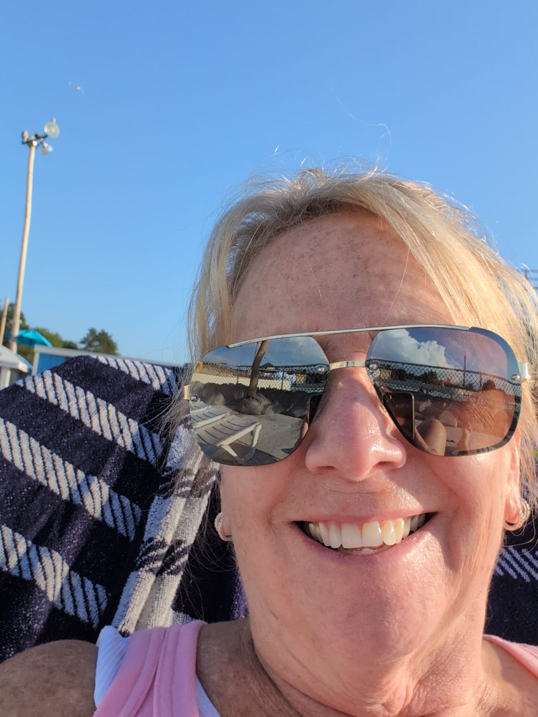 Customer photo review of Unilateral Partial Denture