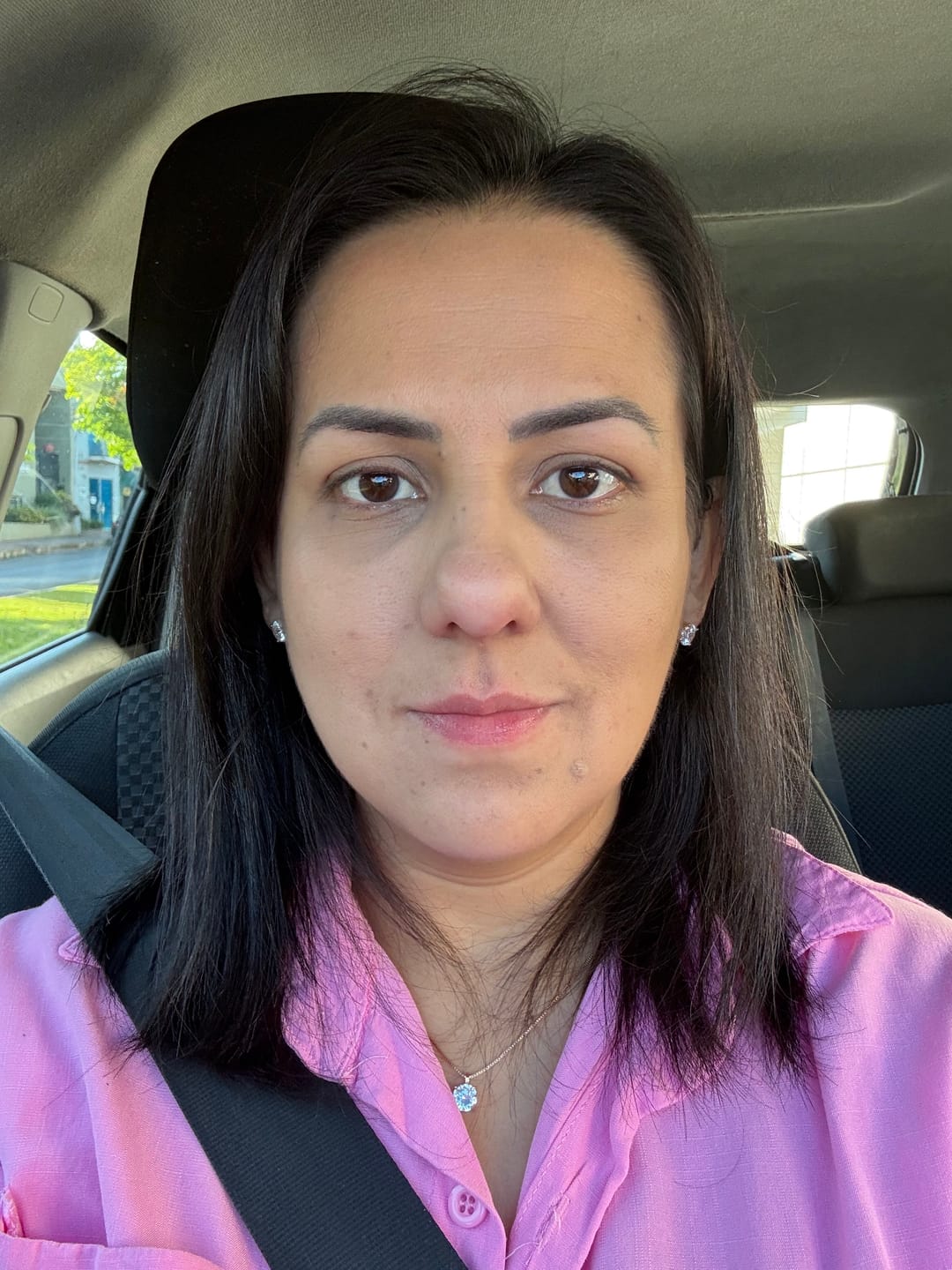 Customer photo review of Creme Clareador de Manchas – Melasma, Axilas, Virilha, Áreas Íntimas, Rosto e Corpo