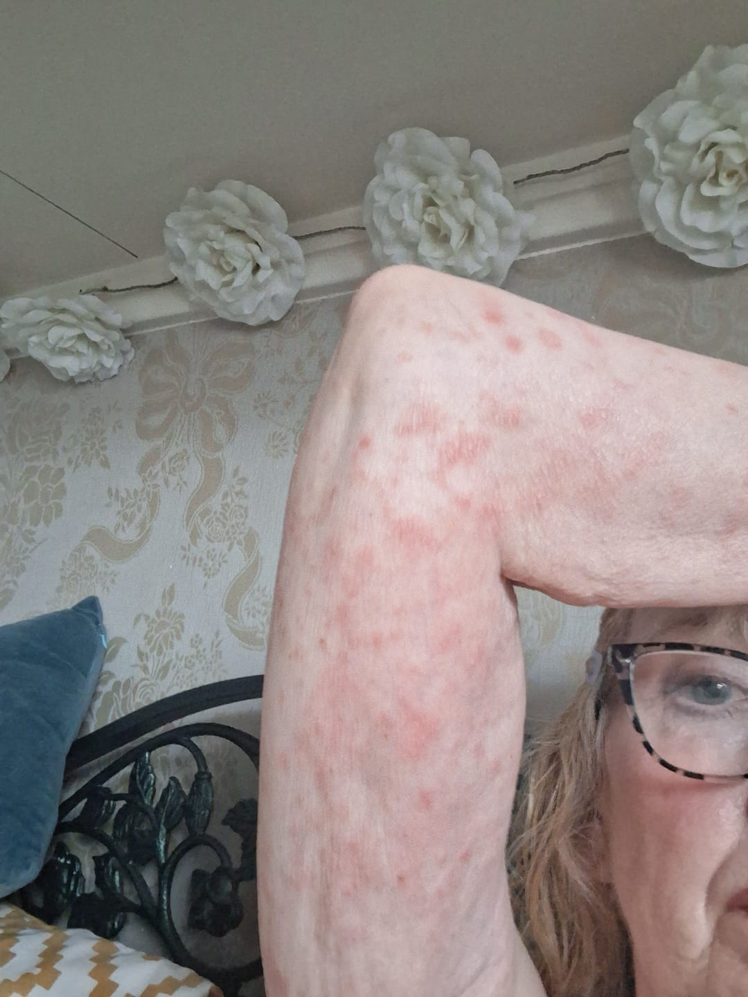 Customer photo review of Seb Natural Calming Serum