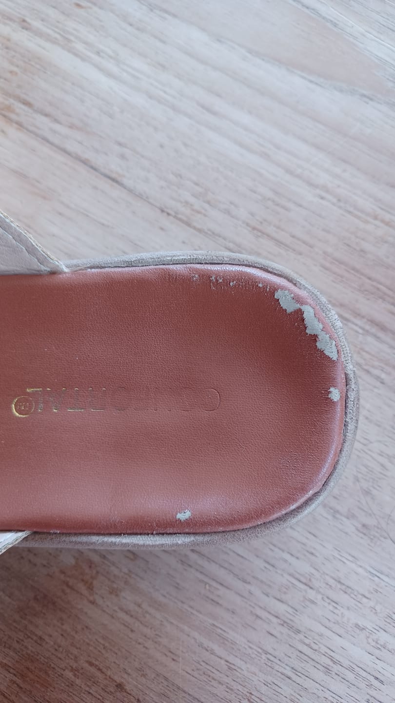 Customer photo review of Sandales Orthopédiques correctrices des Oignons - Hallux Valgus - Gros Orteil