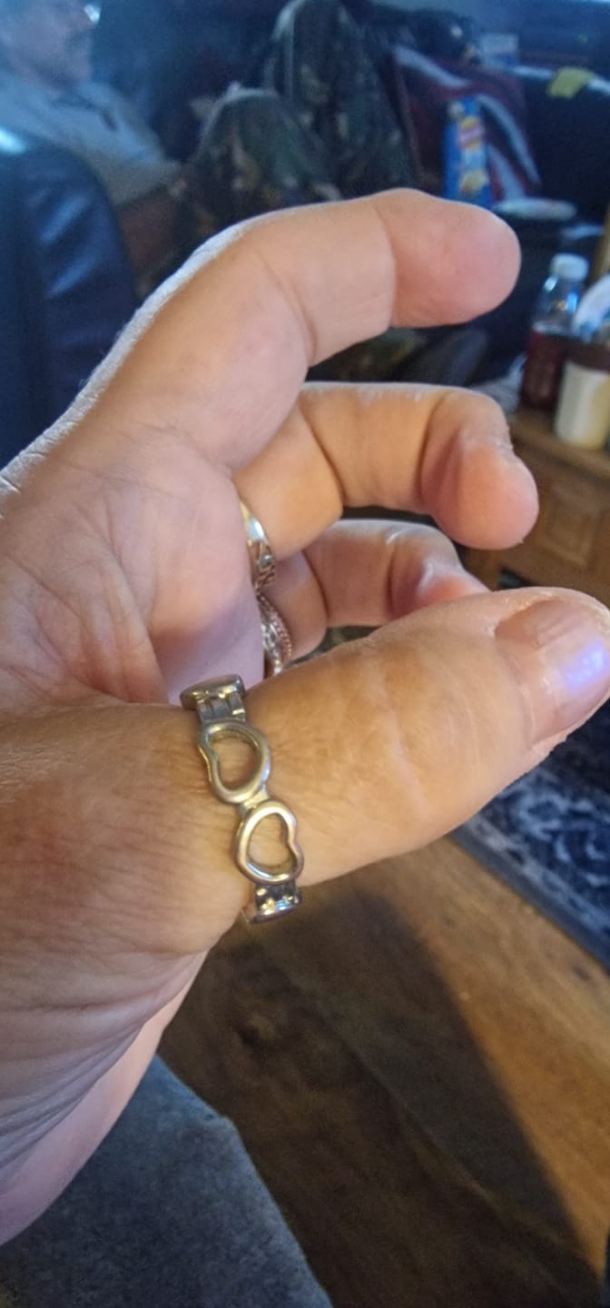 Customer photo review of Health Ring