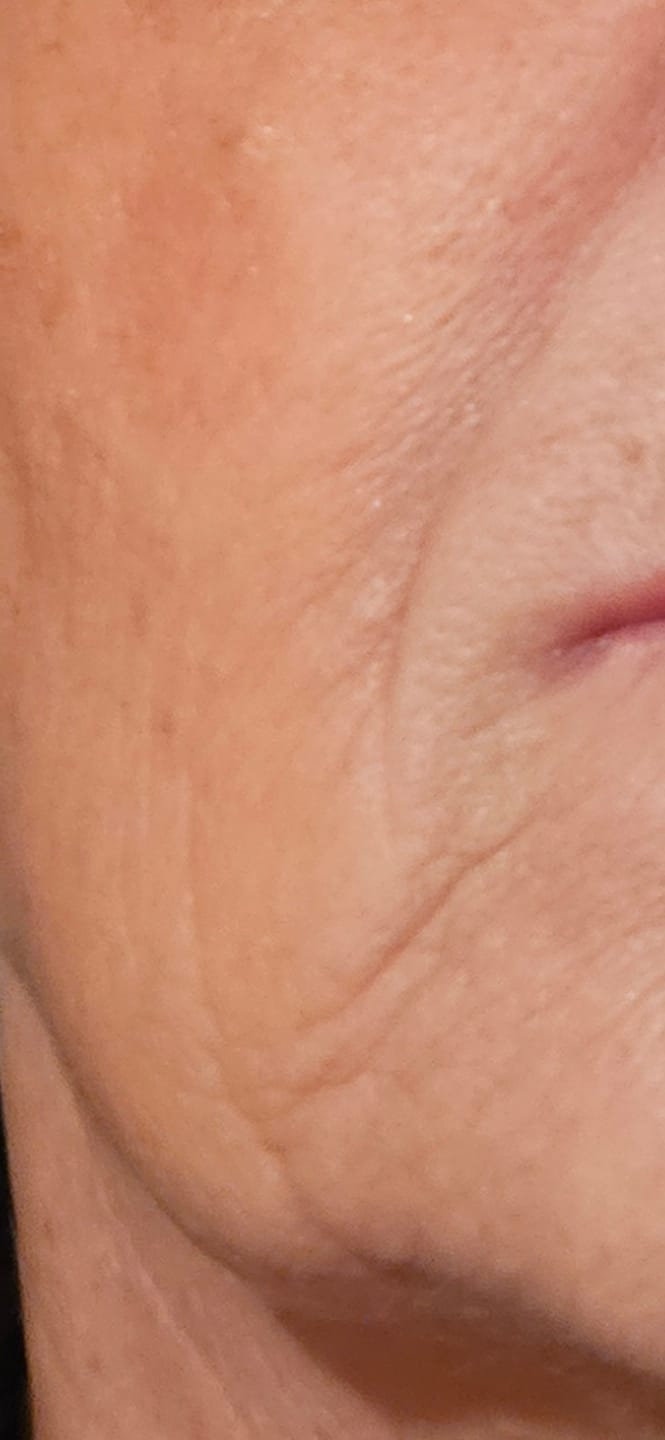 Customer photo review of BioChroma – Siero Coreano Effetto Lifting dalla Prima Applicazione
