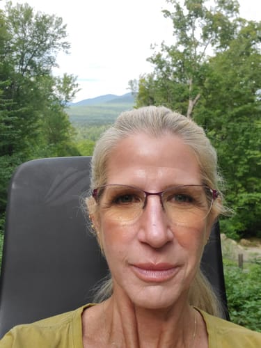 Customer's face showing bright and firm skin after using the Seranova Micro Infusion System.