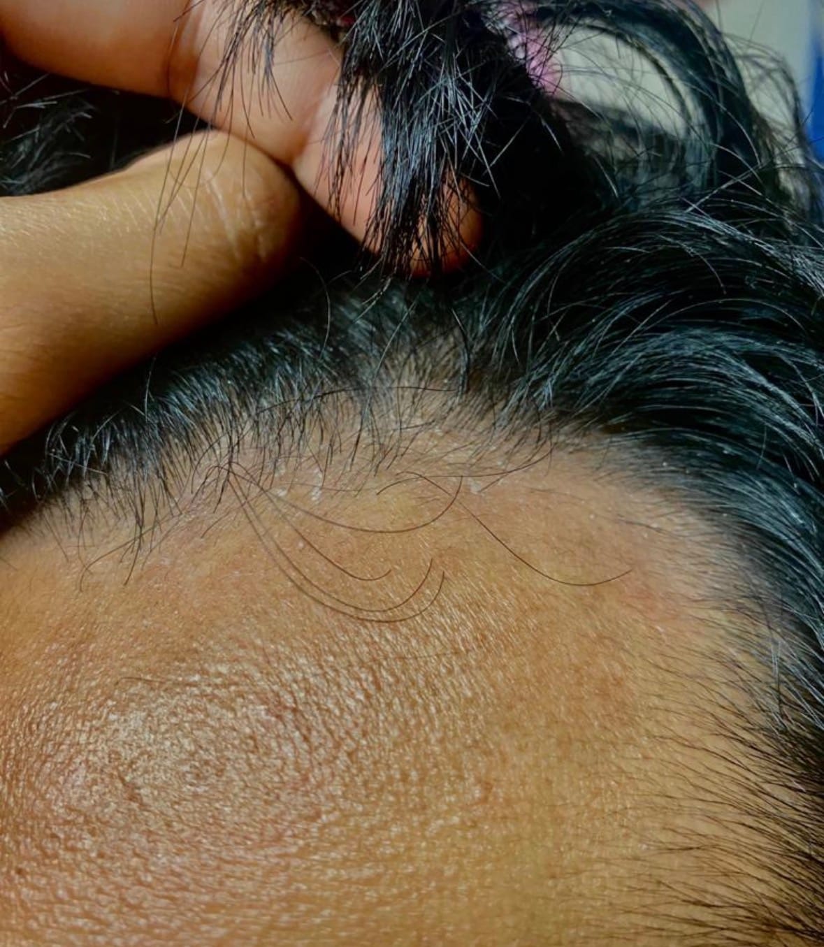 Customer photo review of Seb Natural Calming Serum