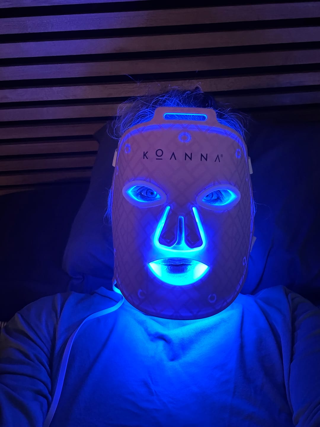 Customer photo review of Koanna® MultiGlo™ LED Light Therapy Mask