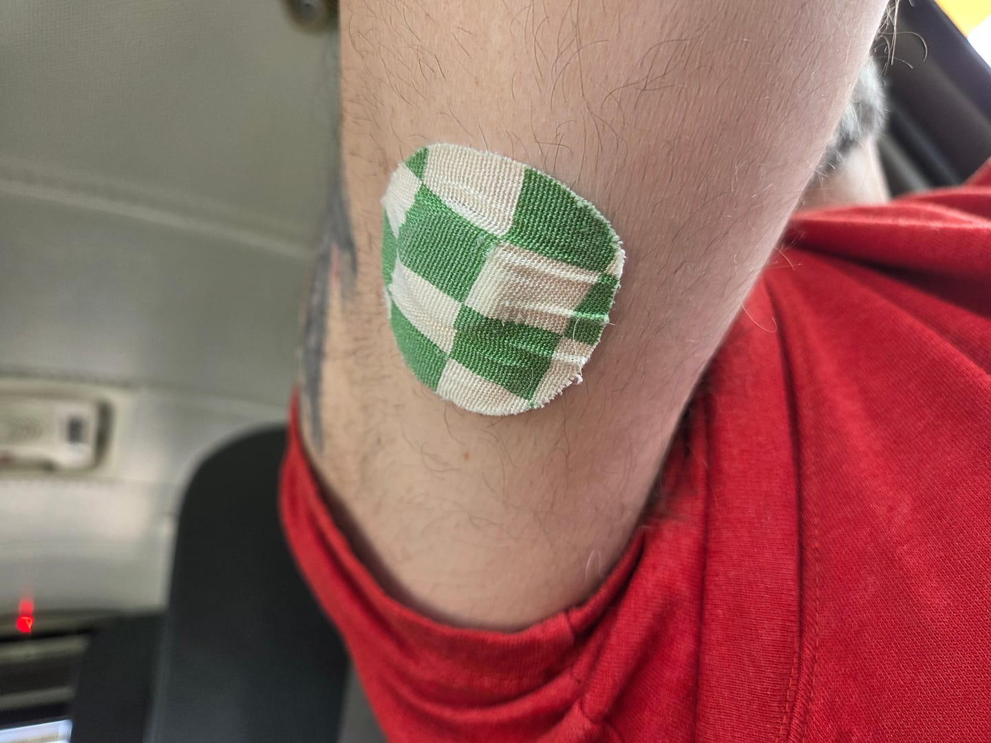 Customer photo review of Skin Grip Original - Instinct Adhesive Patches