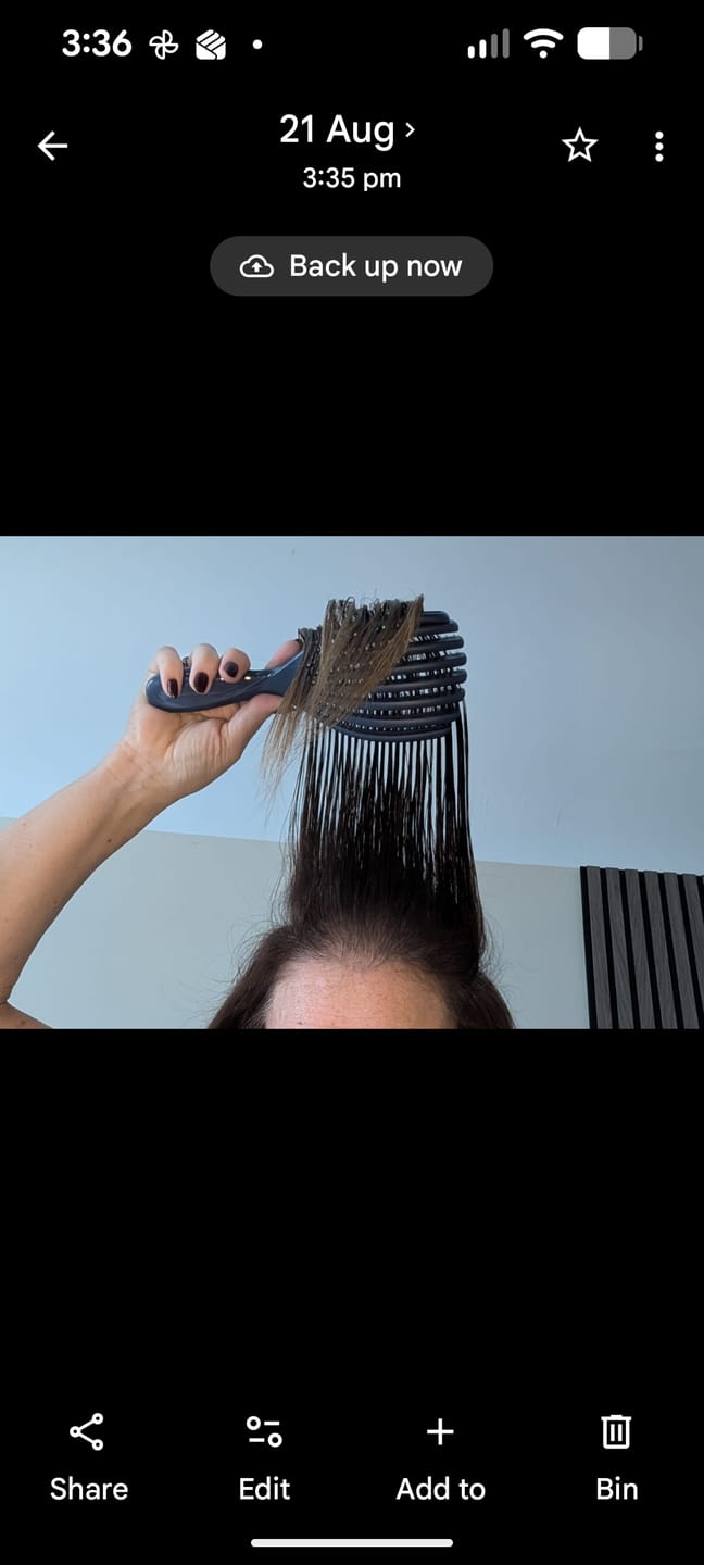 Customer photo review of VITAFOAM ™ Hair Growth Formula