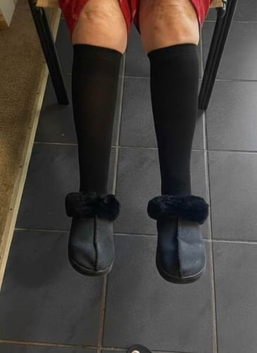 Customer photo review of Calze BambooFlow™ a Compressione punta CHIUSA – Gambe leggere tutto il giorno!