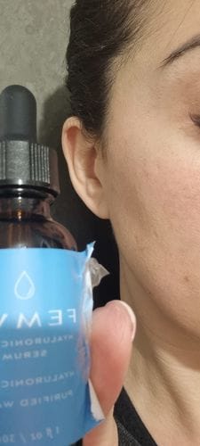 Customer photo review of Peachaboo Hyaluronic Acid Serum