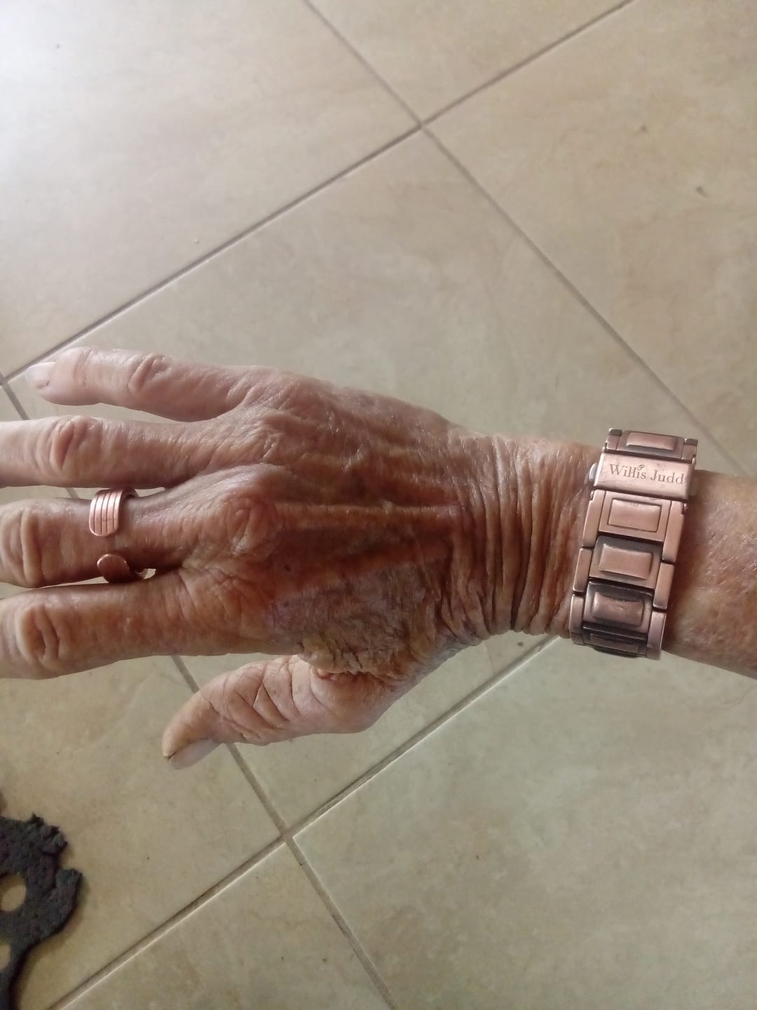 Customer photo review of Mens Adjustable Copper Magnetic Ring