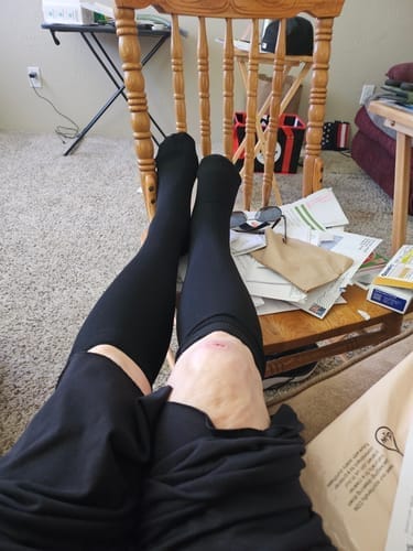 Customer photo review of Calze BambooFlow™ a Compressione punta CHIUSA – Gambe leggere tutto il giorno!