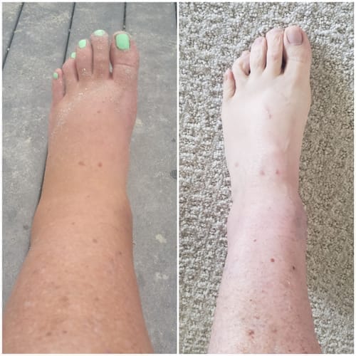 Customer photo review of Calze BambooFlow™ a Compressione punta CHIUSA – Gambe leggere tutto il giorno!