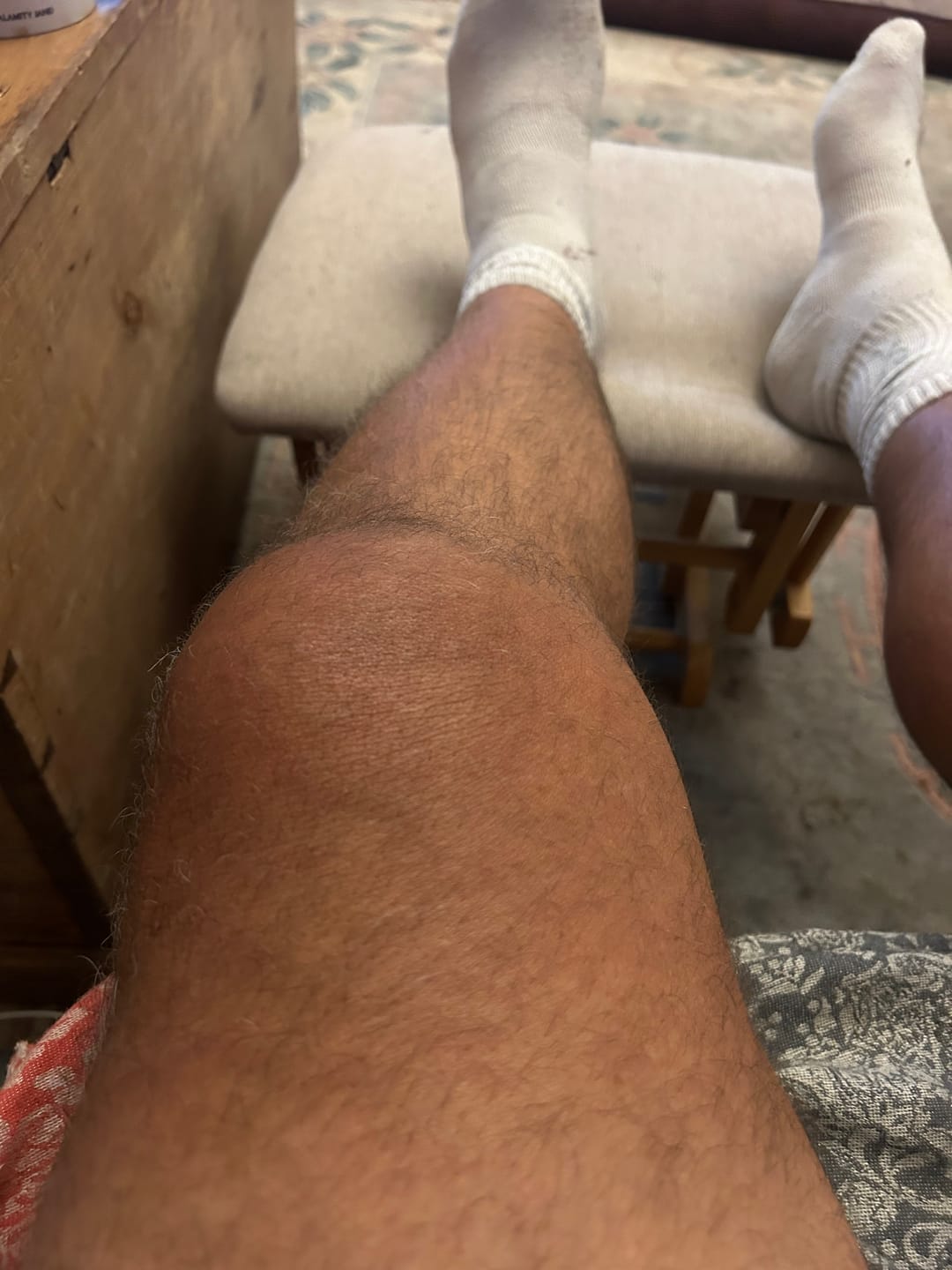 Customer photo review of Knee Support For Arthritic Relief & Pain Recovery