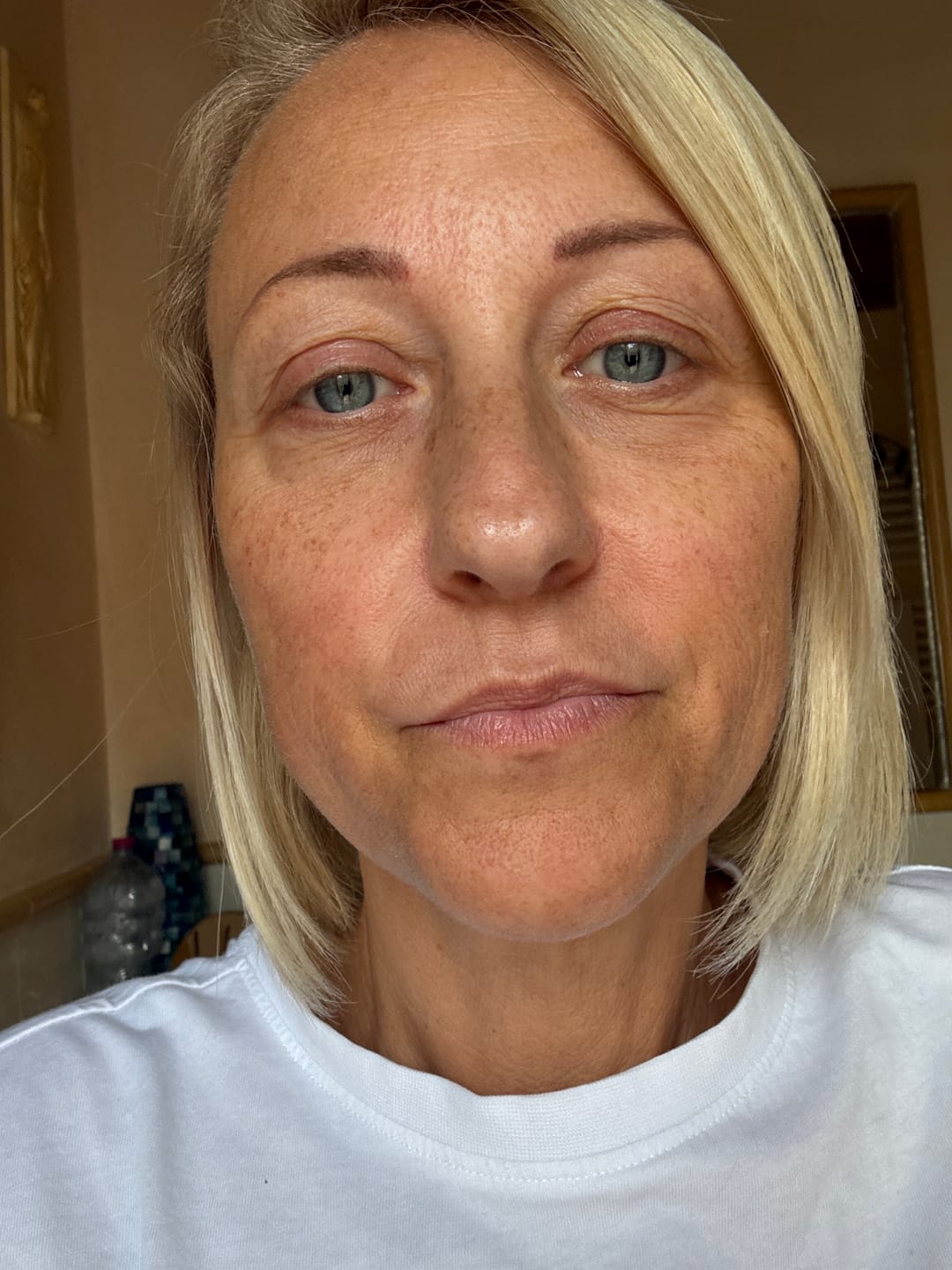 Customer photo review of Contorno Occhi Calcium Lift™