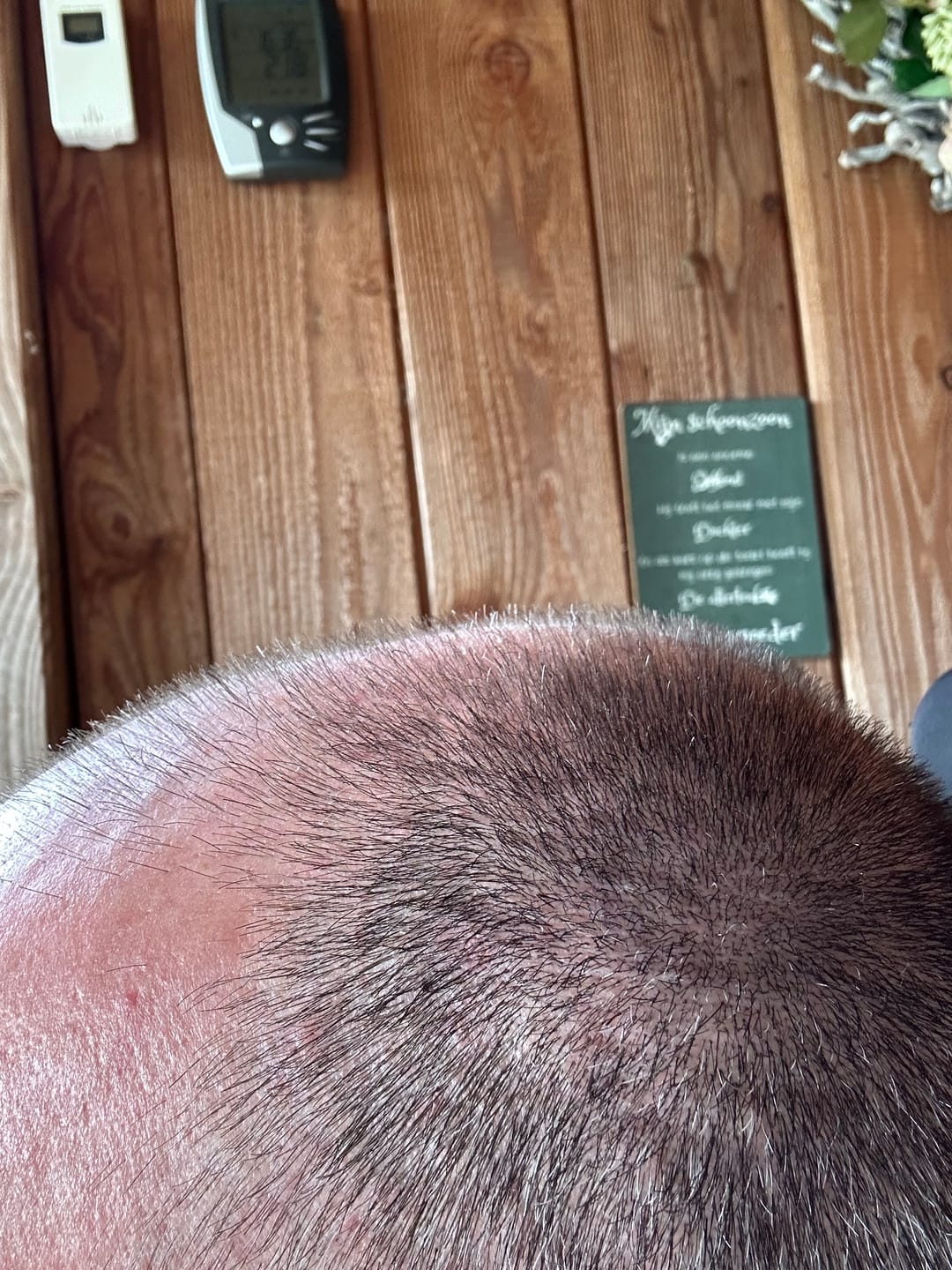 Customer photo review of Wahl Detailer Li Cordless Trimmer