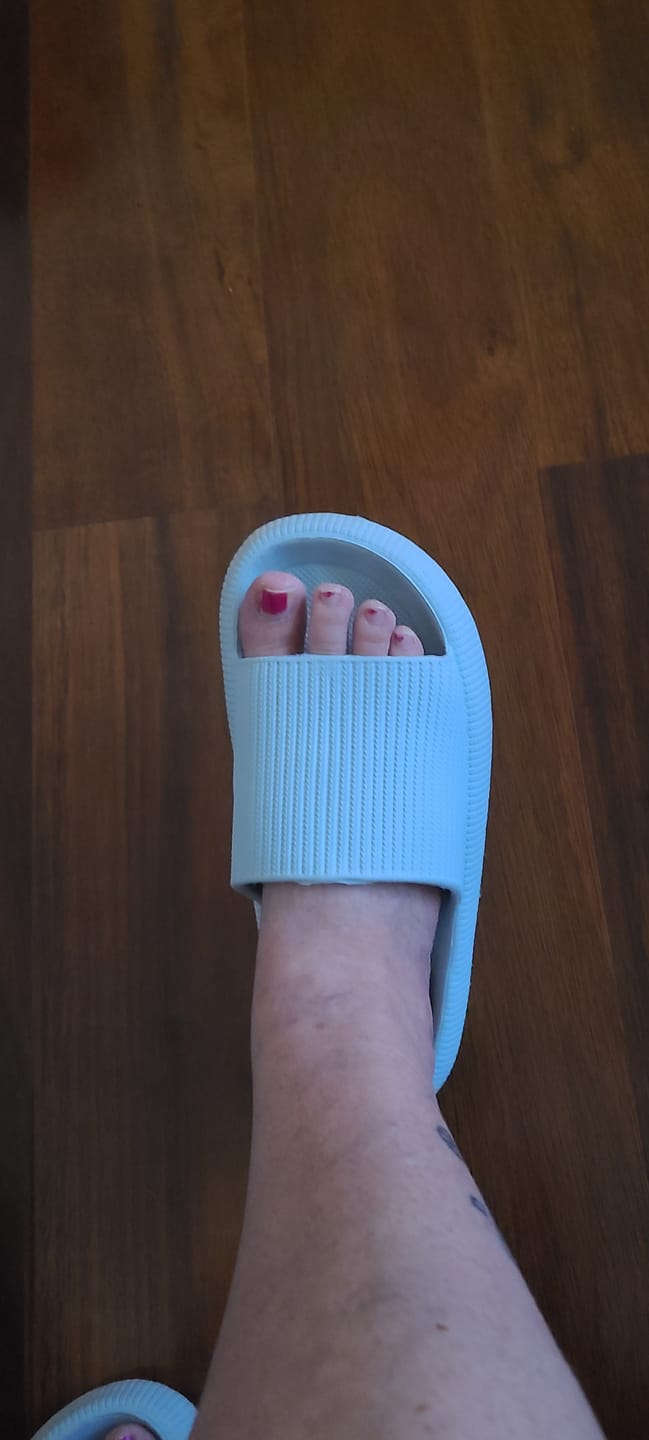 Customer photo review of Cloud Slides - Original Cushion Comfort