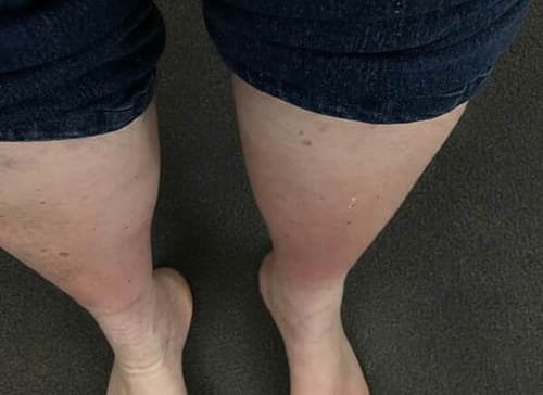 Customer photo review of Calze BambooFlow™ a Compressione punta CHIUSA – Gambe leggere tutto il giorno!