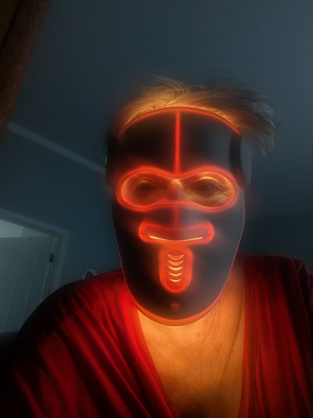 Customer photo review of Hatch Halo™ Dermatologist Grade 3-in-1 Light Therapy Mask