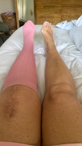 Customer photo review of Calze BambooFlow™ a Compressione punta CHIUSA – Gambe leggere tutto il giorno!