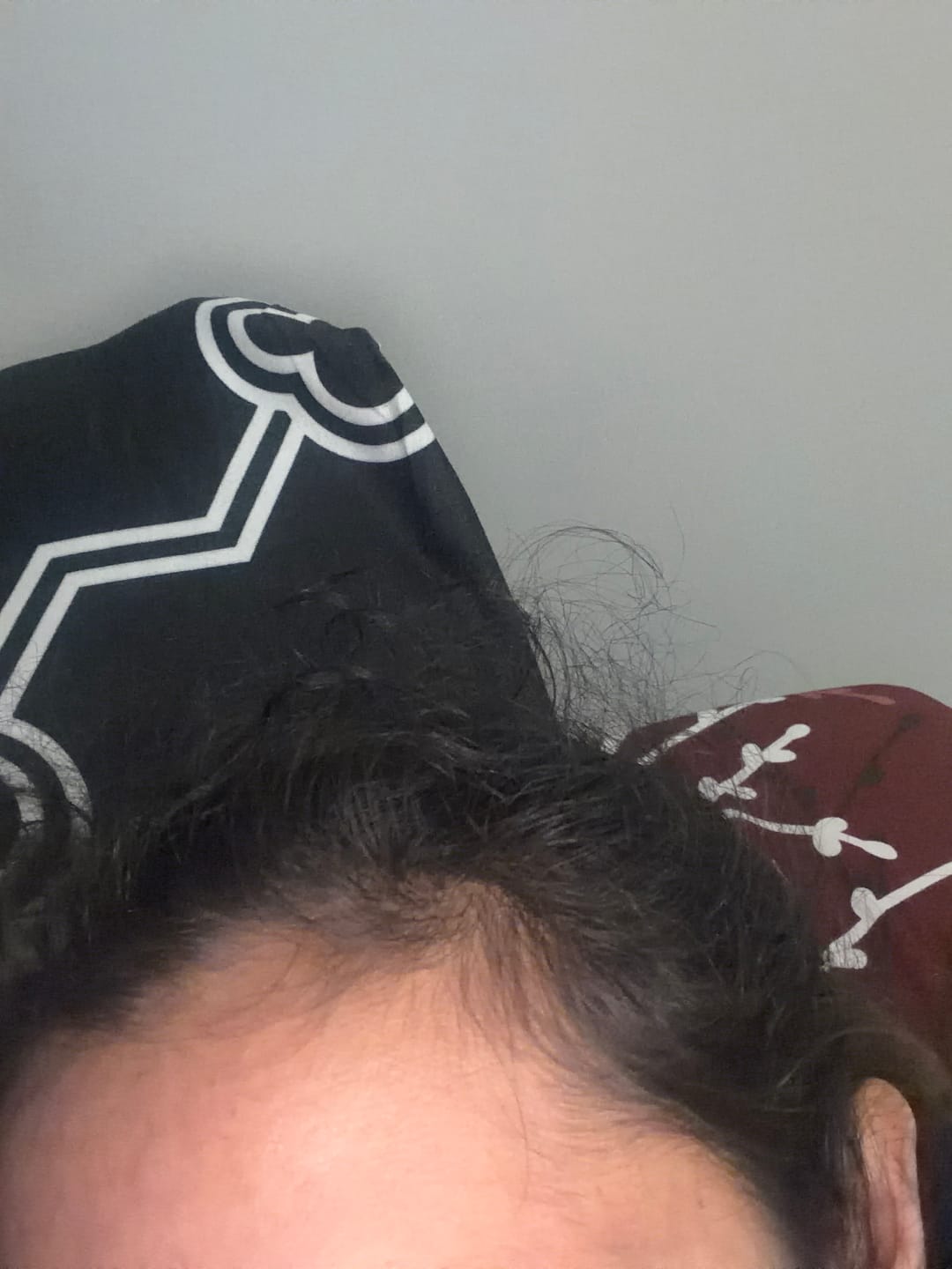 Customer photo review of EBOOK - Thicker hair in 5 weeks