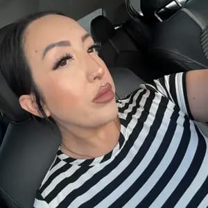 Customer photo review of Korean NAD+ EGF Firming Serum
