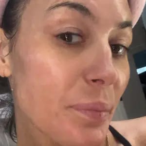 Customer photo review of Korean NAD+ EGF Firming Serum