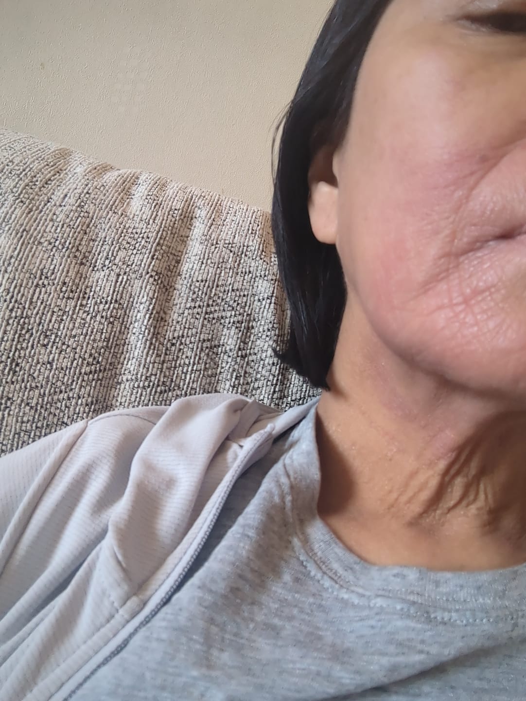 Customer photo review of Seb Natural Calming Serum