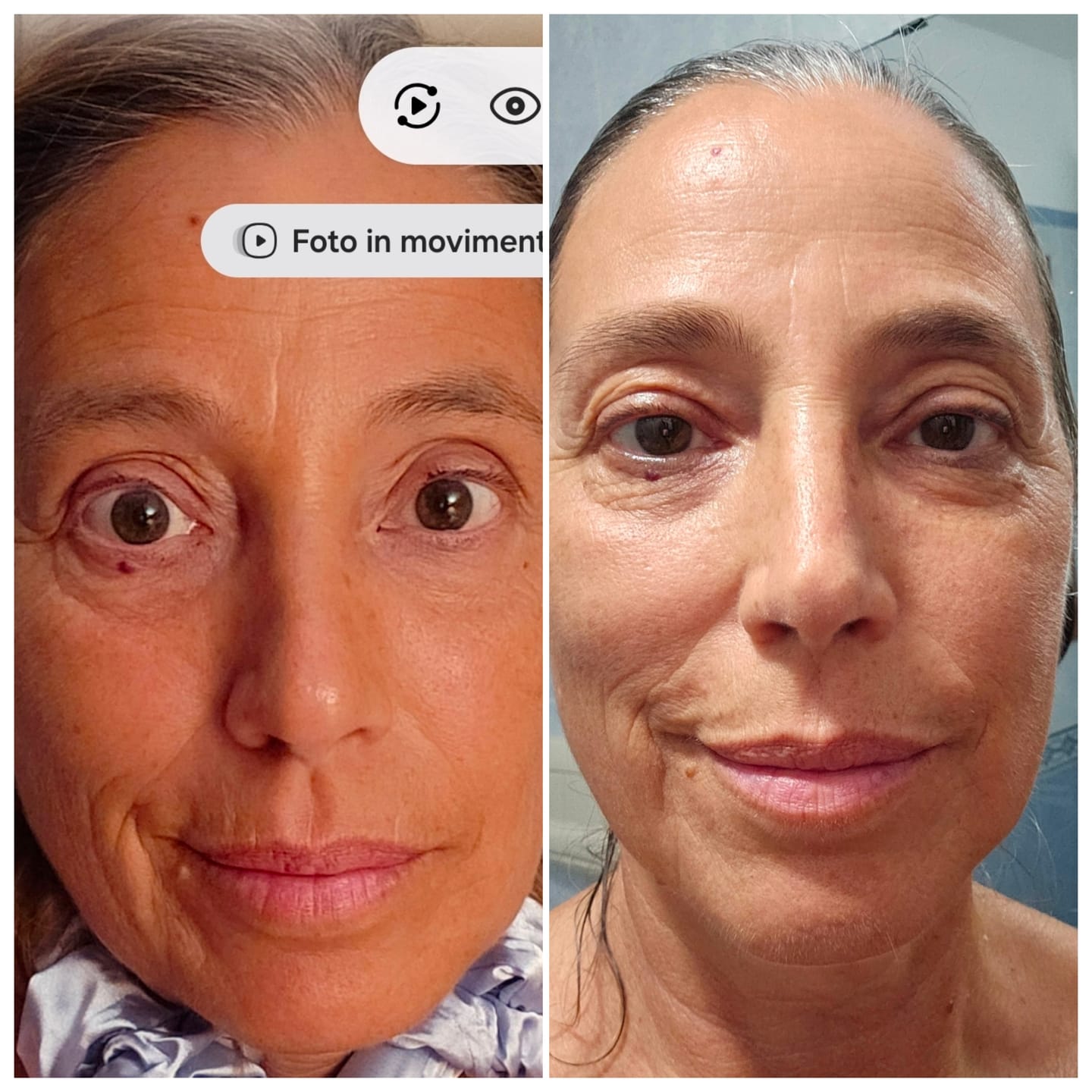 Customer photo review of BioChroma – Siero Coreano Effetto Lifting dalla Prima Applicazione