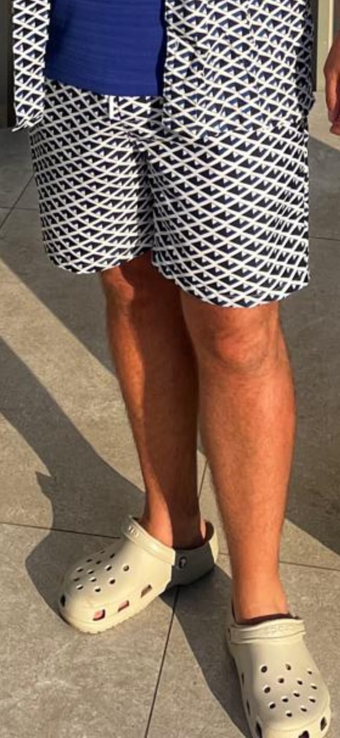 Customer photo review of Unisex Crocs Classic Clog