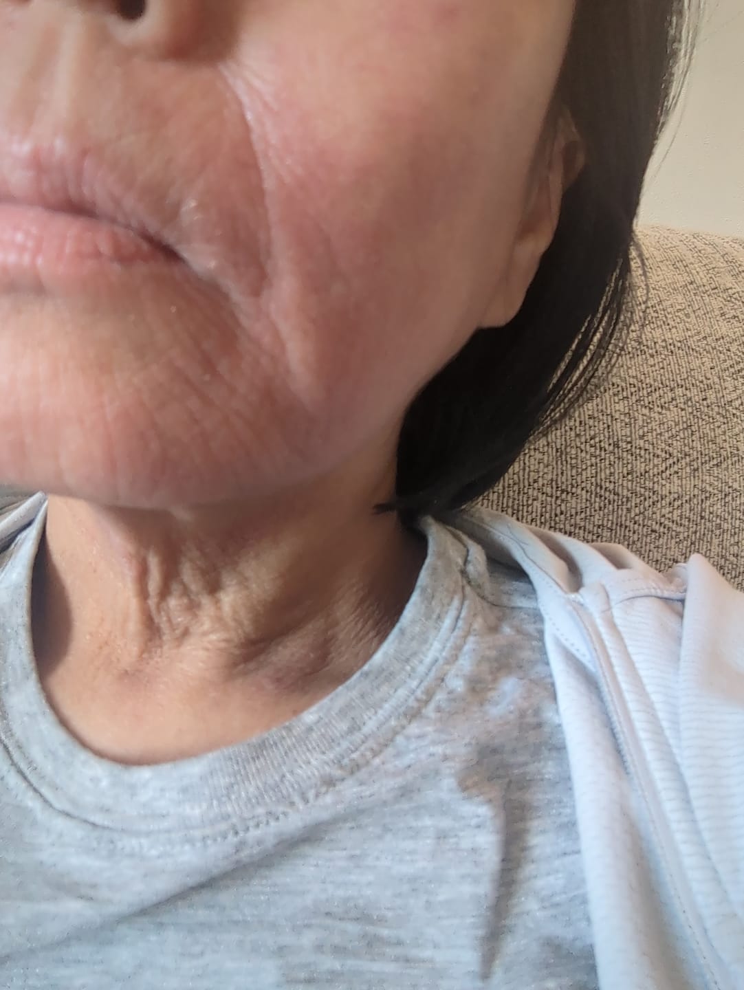 Customer photo review of Seb Natural Soothing Balm
