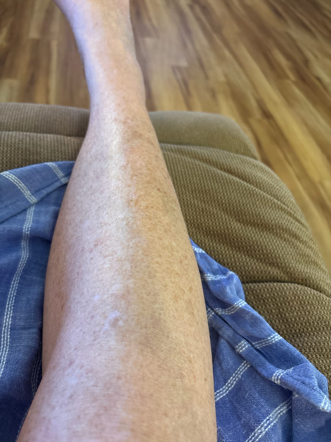 Customer photo review of Botanical Body Oil™