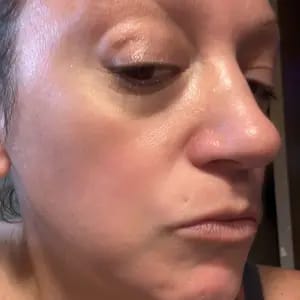Customer photo review of Korean NAD+ EGF Firming Serum