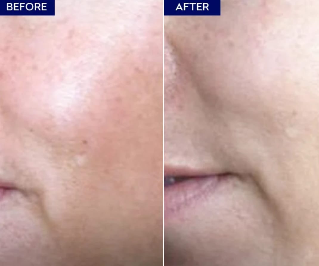 Customer photo review of Maxdif Brightening Serum