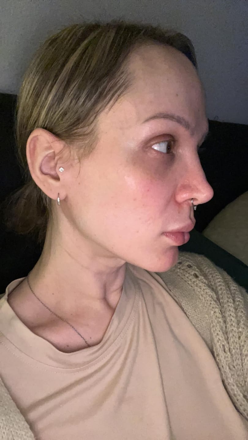 Customer photo review of Peptide Firming Toner