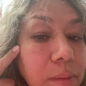 Customer photo review of Korean NAD+ EGF Firming Serum