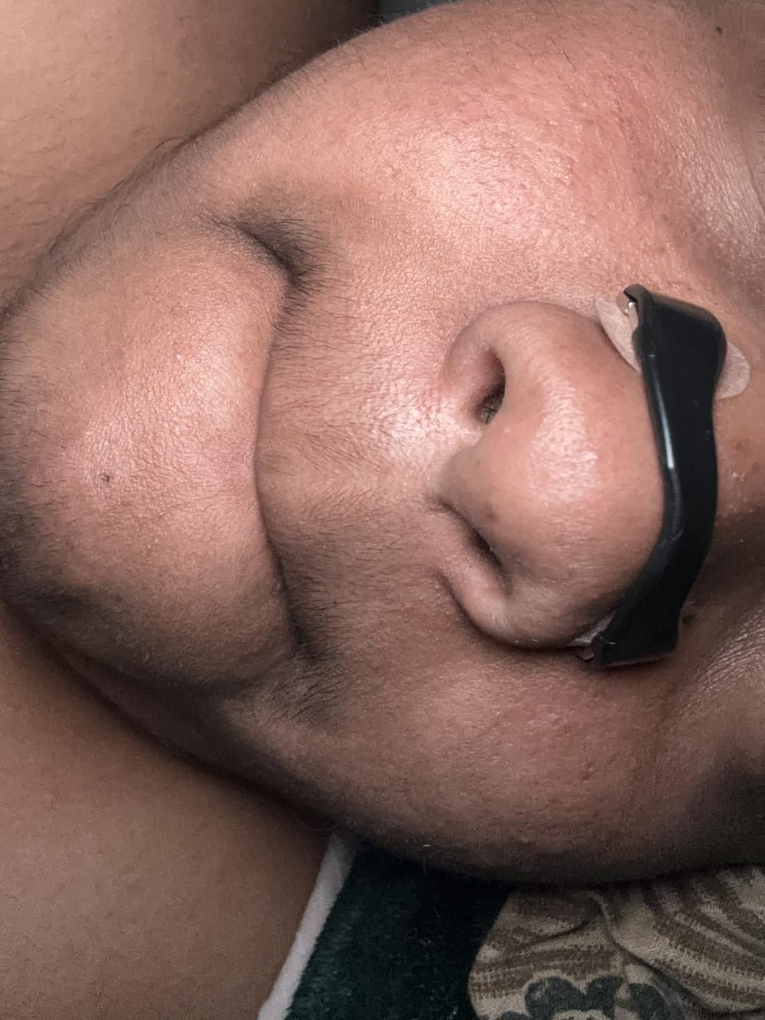 Customer photo review of Magnetic Nasal Strips
