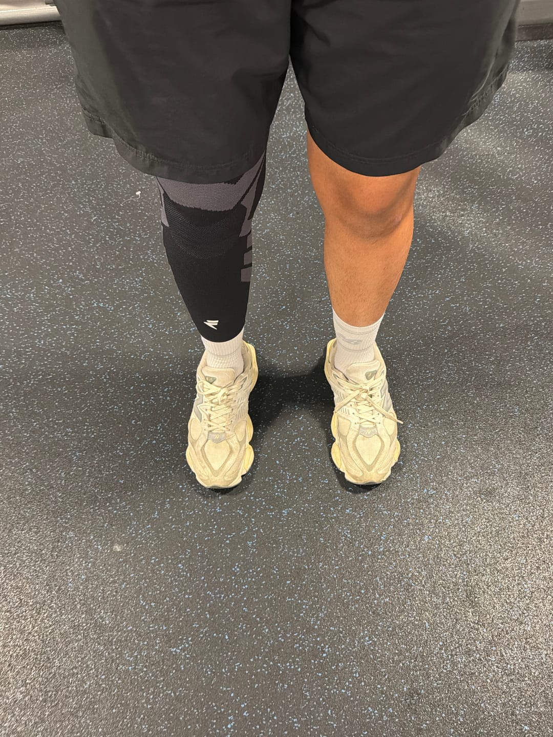 Customer photo review of Compression Sleeves V2 for Knees and Legs