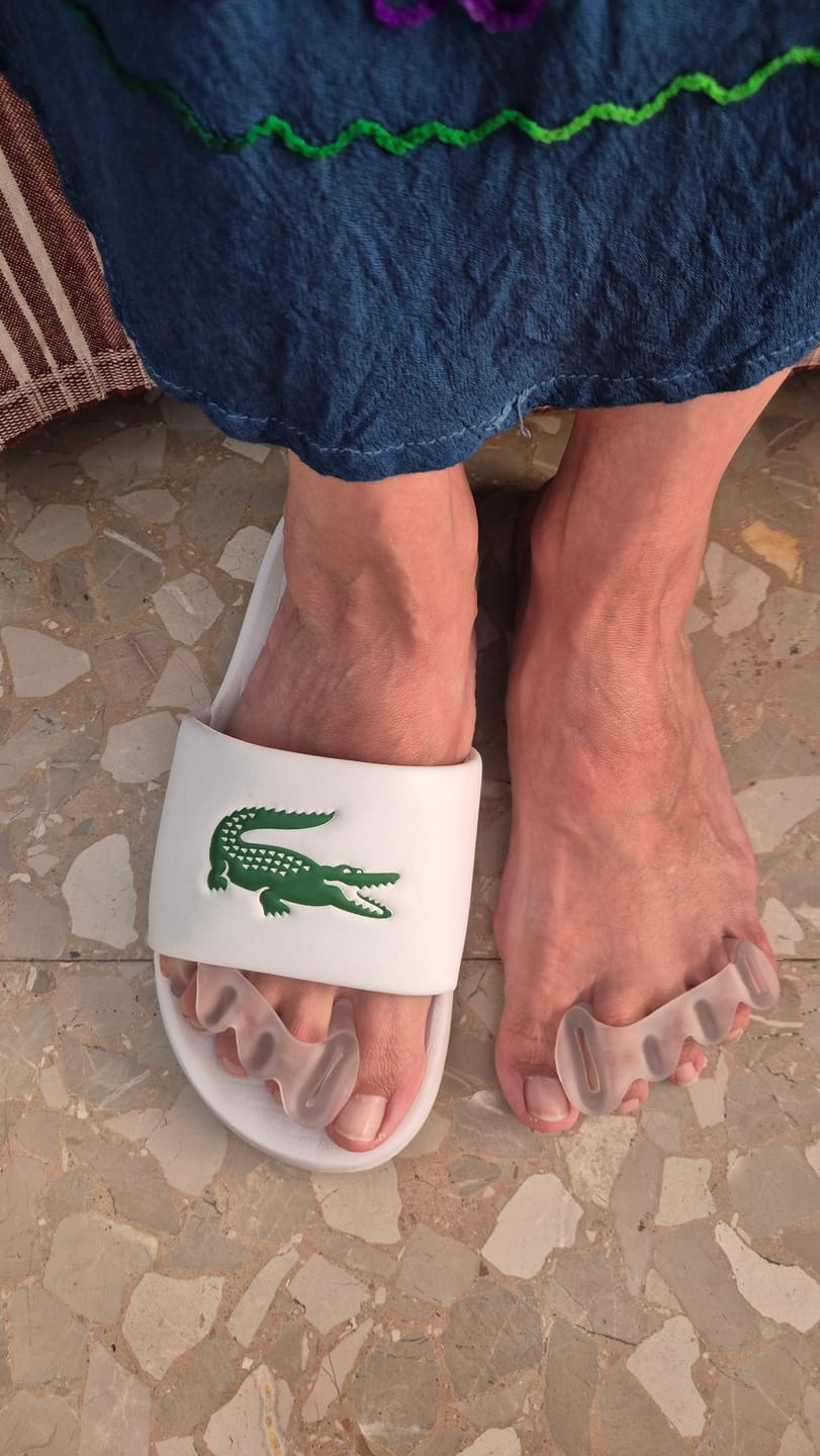 Customer photo review of Espaciadores de dedos- Soft