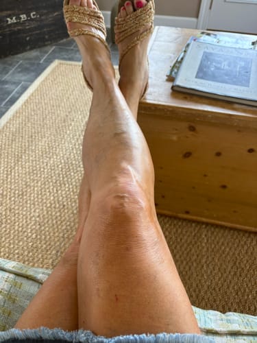 Customer's legs showing hydrated skin after using the Body Serum, wearing woven sandals while sitting.