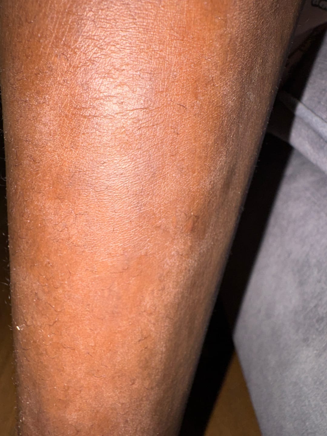 Customer photo review of Baume vitamine C Showersilk