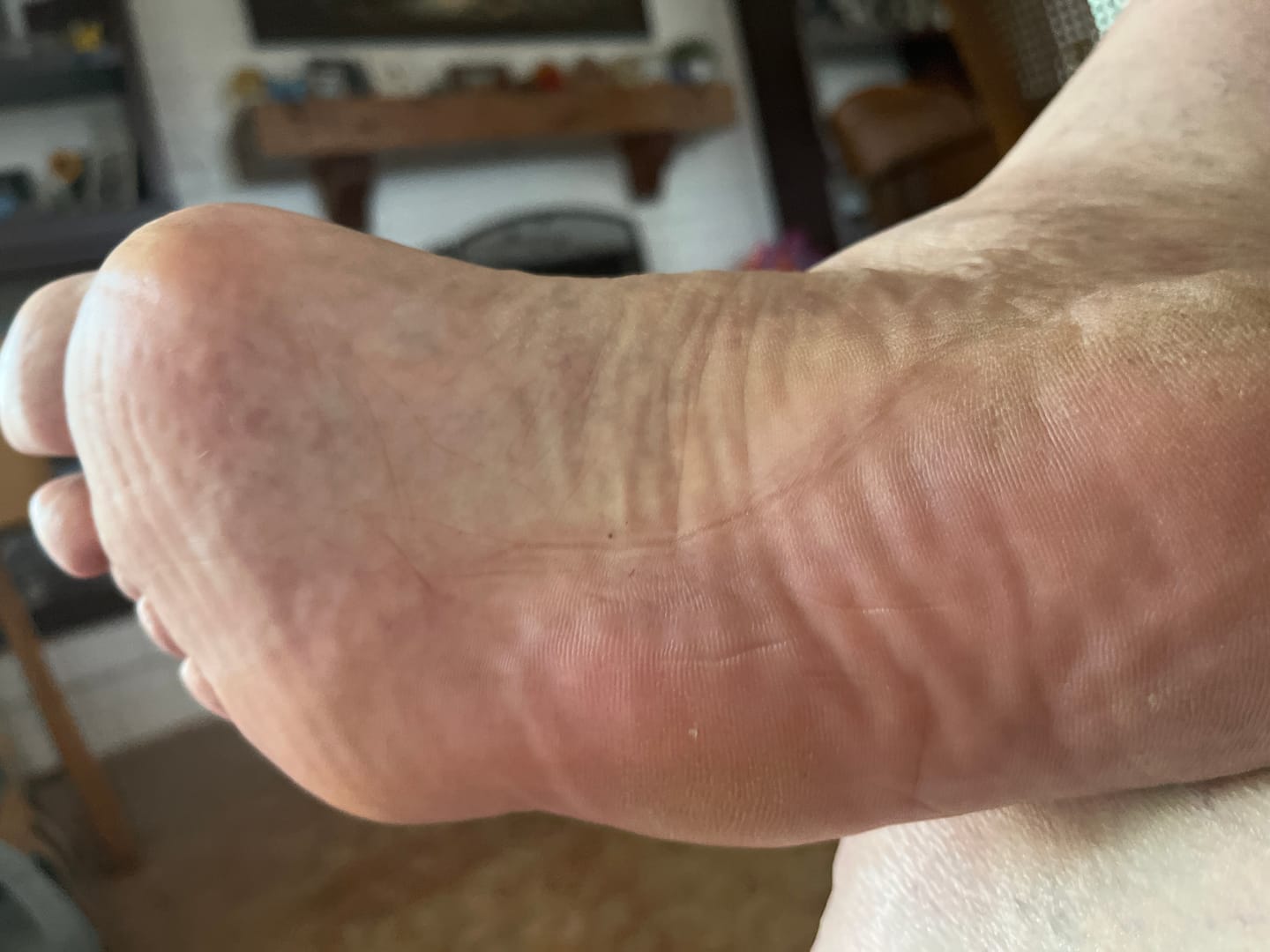 Customer photo review of The Original Mama Bear Nerve Relief Lotion