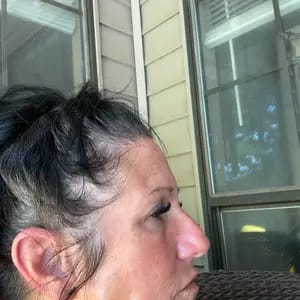 Customer photo review of Korean NAD+ EGF Firming Serum