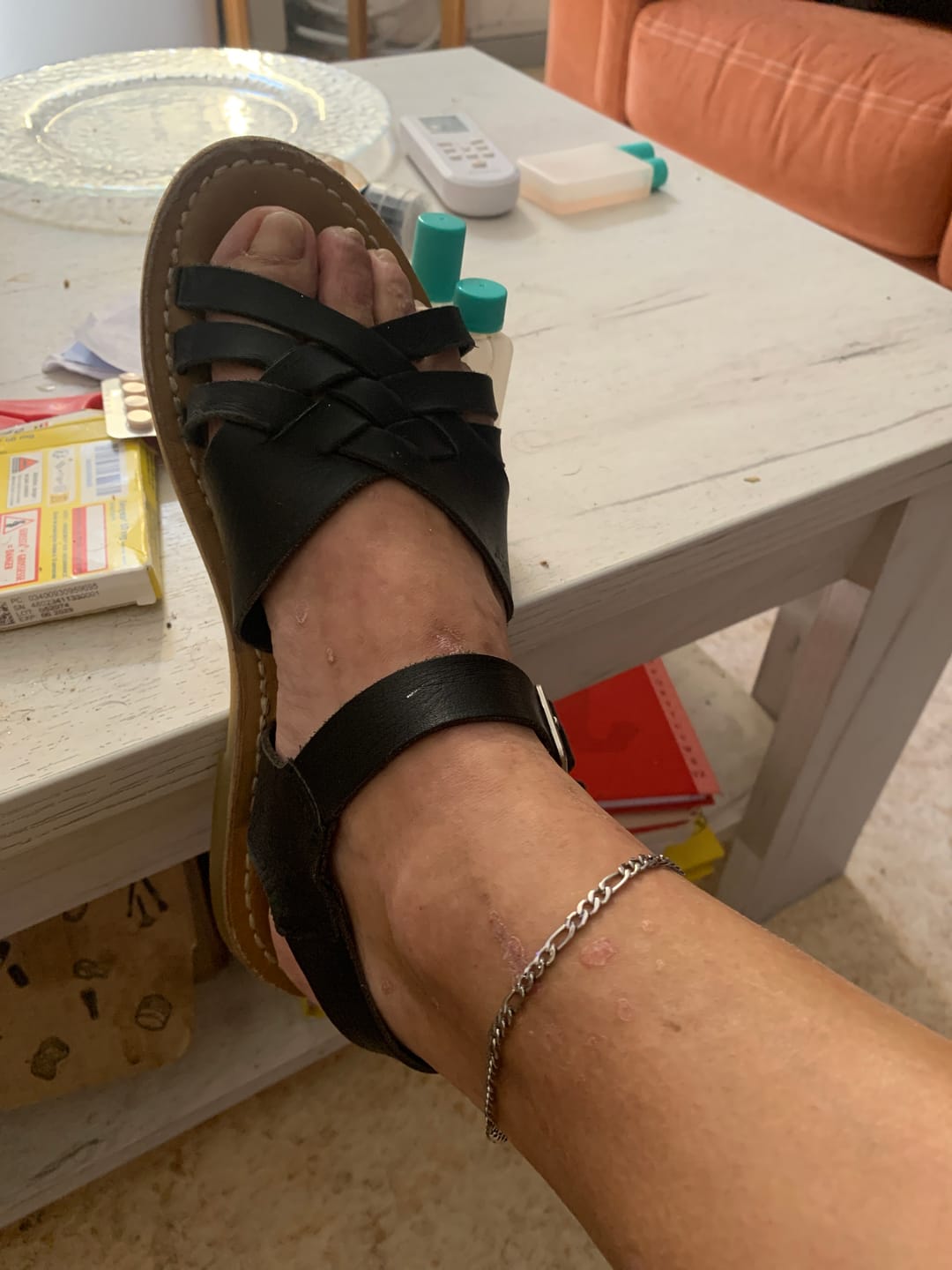 Customer photo review of Tobillera Force