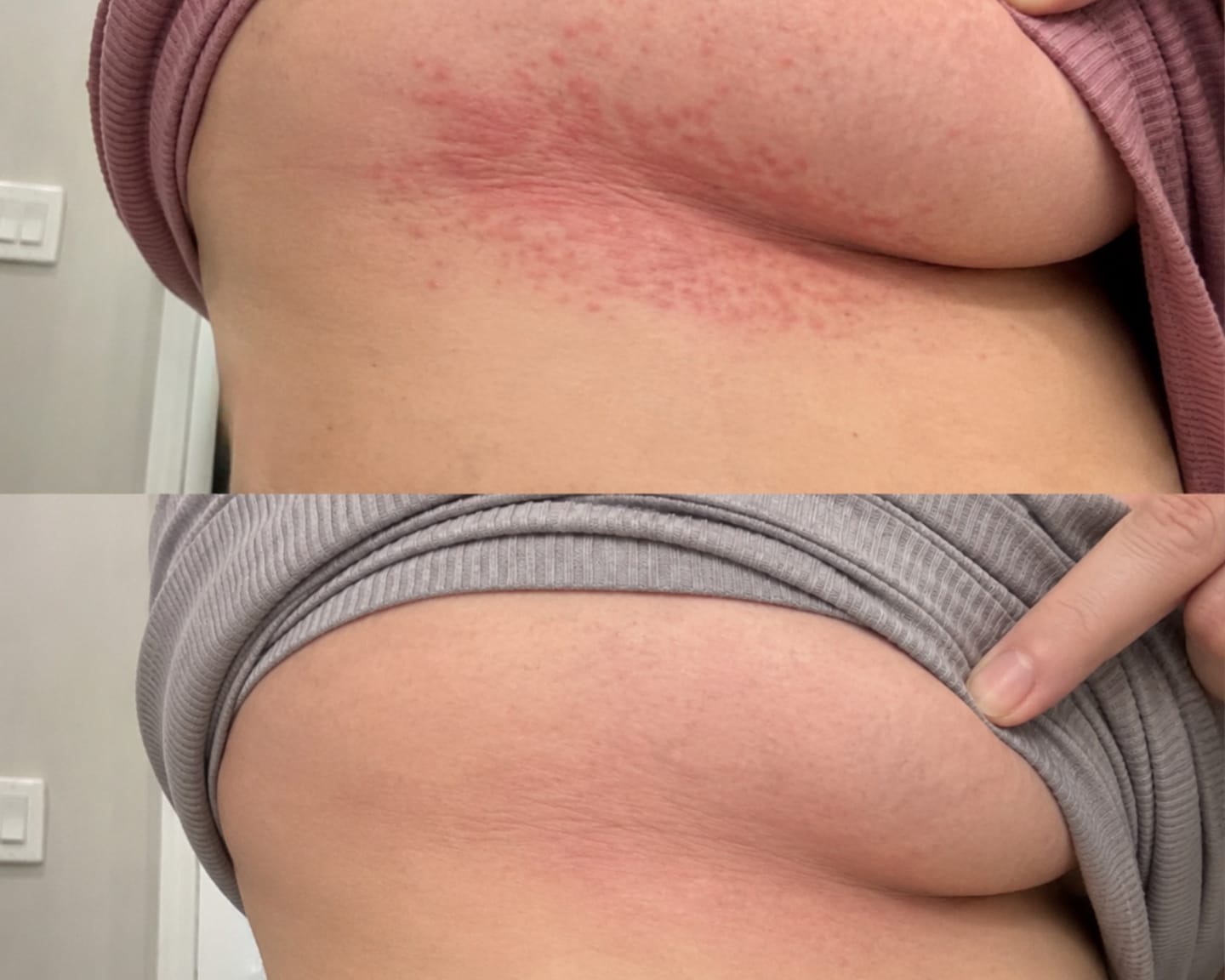 Customer photo review of Jabón de Tea Tree para la Comezón debajo del Busto
