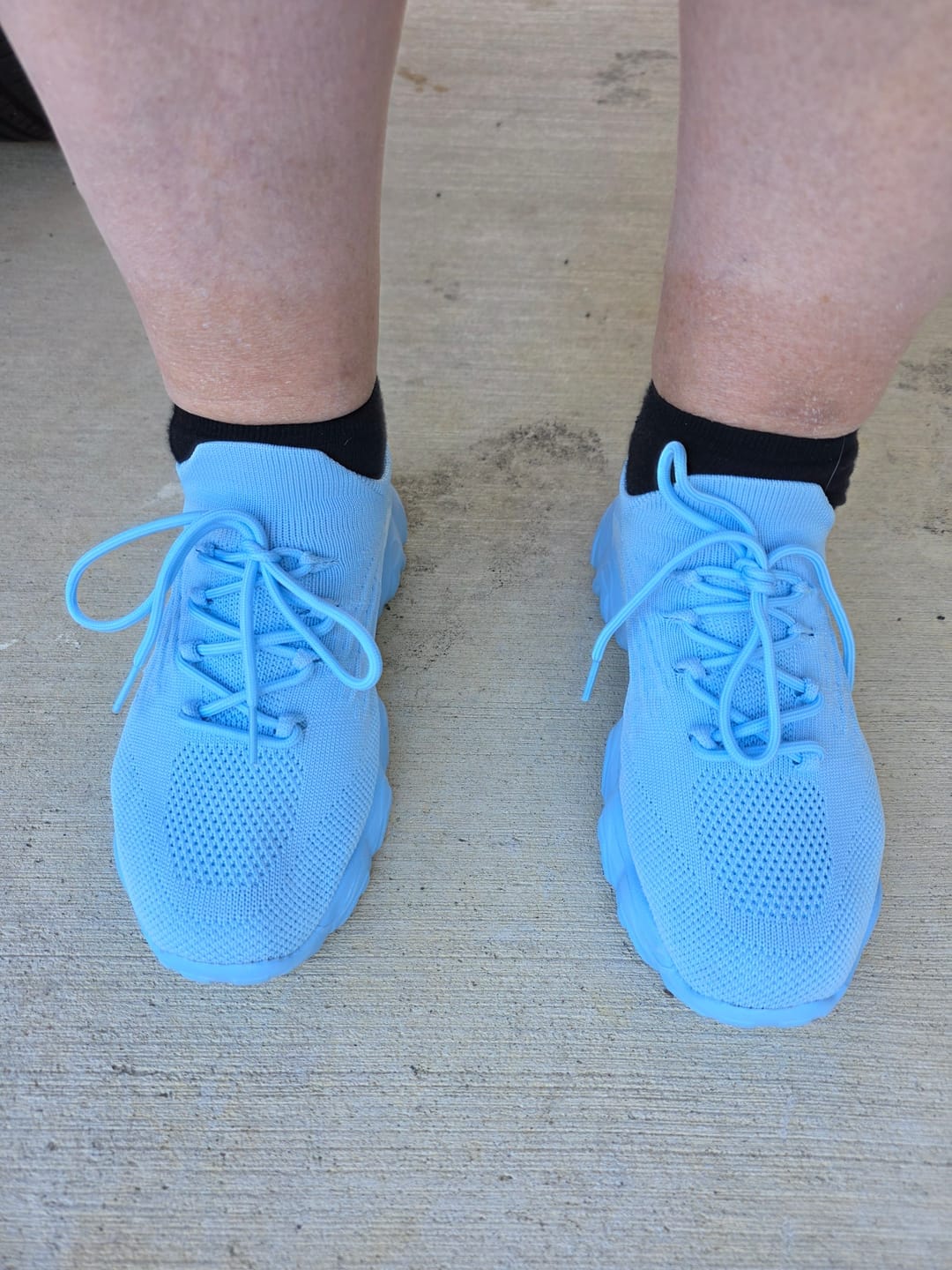 Customer photo review of Ortho Pro