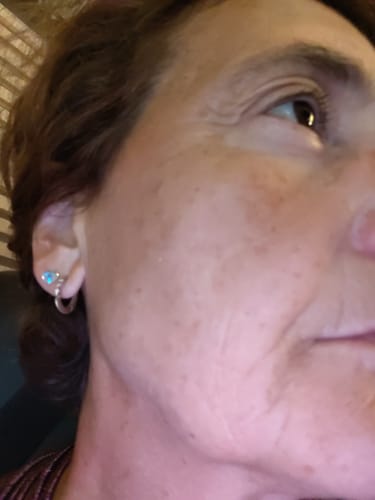 Recensione con foto di un cliente su BioChroma – Siero Coreano Effetto Lifting dalla Prima Applicazione