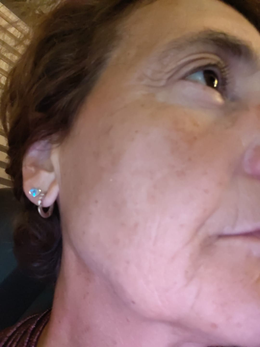 Customer photo review of BioChroma – Siero Coreano Effetto Lifting dalla Prima Applicazione