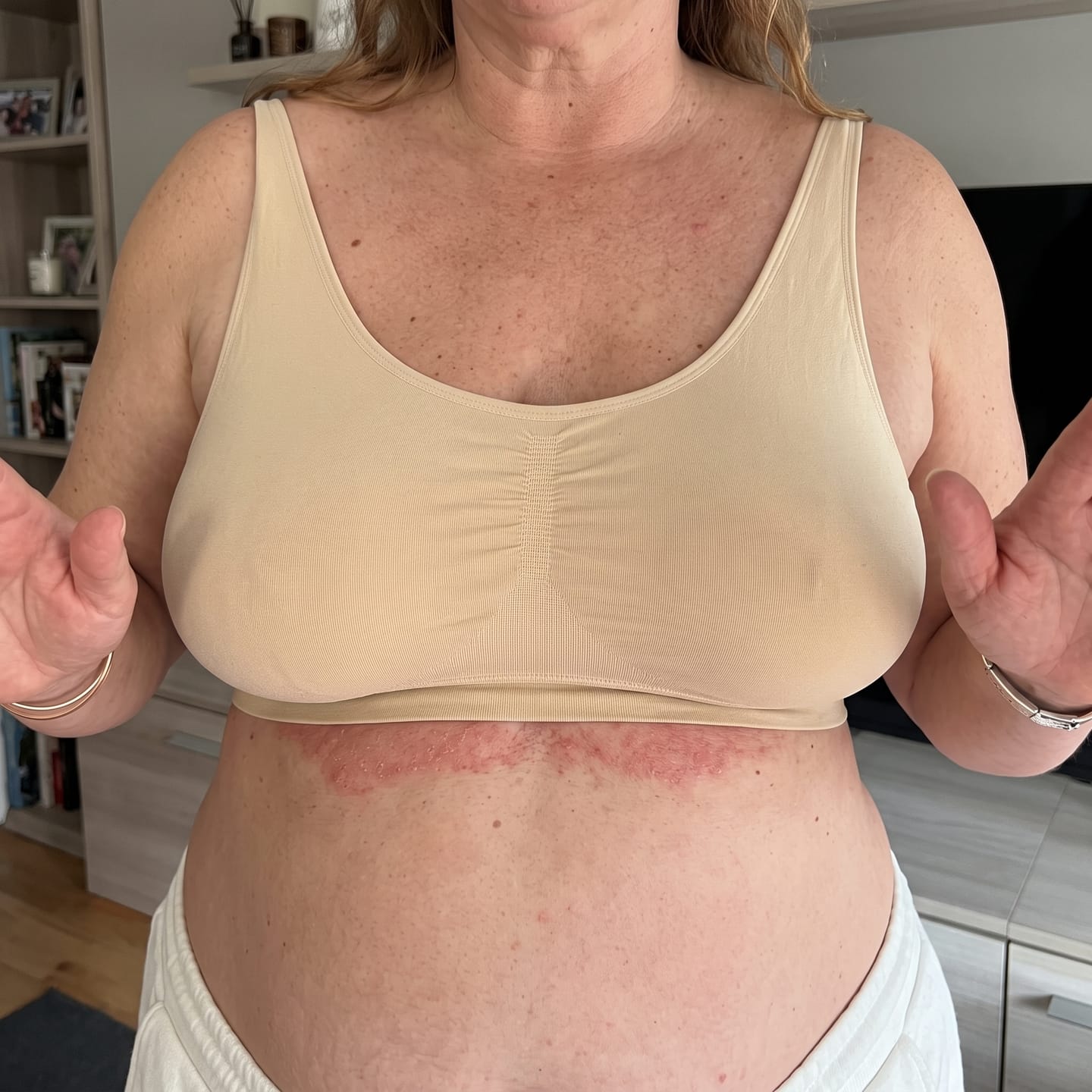 Customer photo review of Jabón de Tea Tree para la Comezón debajo del Busto