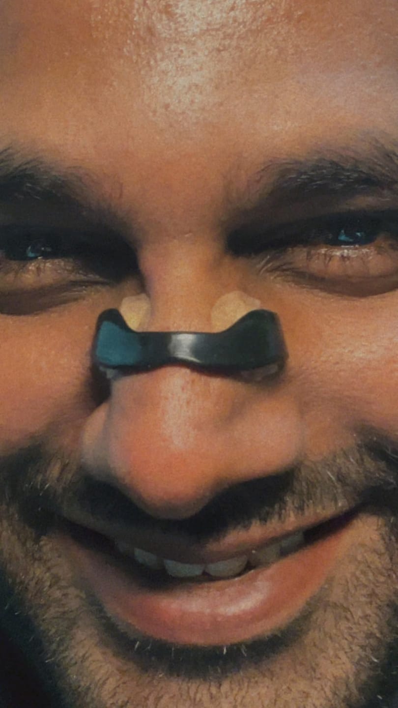 Customer photo review of Magnetic Nasal Strips