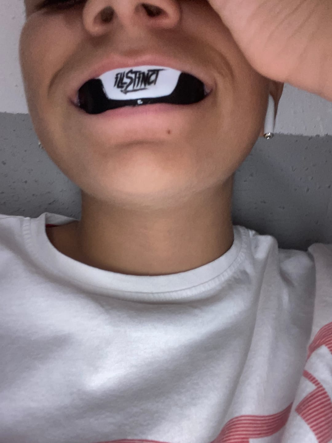 Customer photo review of CombatGuard Bandagen
